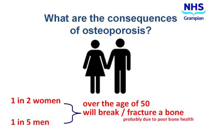 Consequences Of Osteoporosis